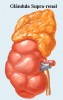 suprarrenal-gnosisonline